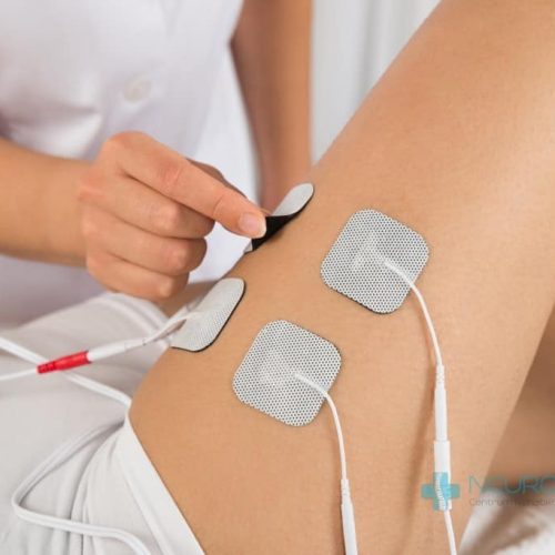 Close-up Of Therapist Placing Electrodes On Woman's Thigh